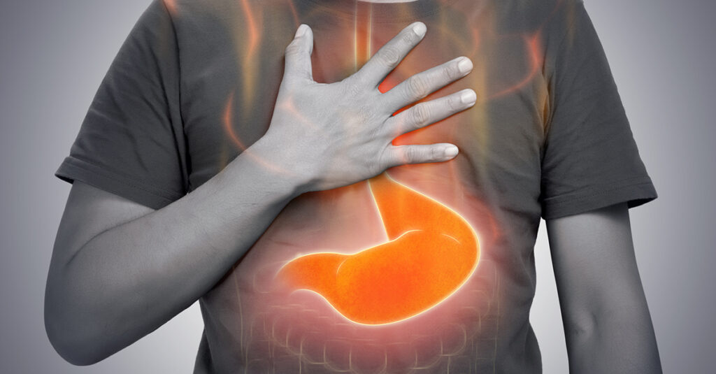 Veteran experiencing gerd symptoms and chest discomfort.