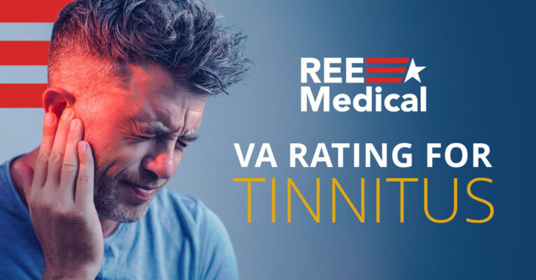 VA rating for tinnitus.