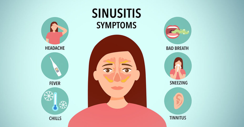 Sinusitis symptoms illustrated graphic.