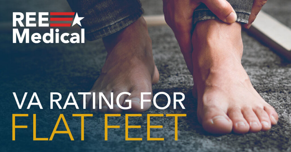 VA rating for flat feet.