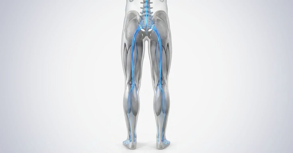 VA rating for restless leg syndrome challenges.