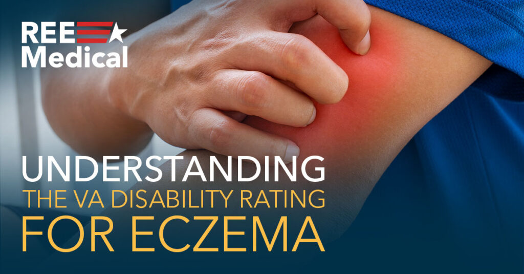 VA rating for eczema.