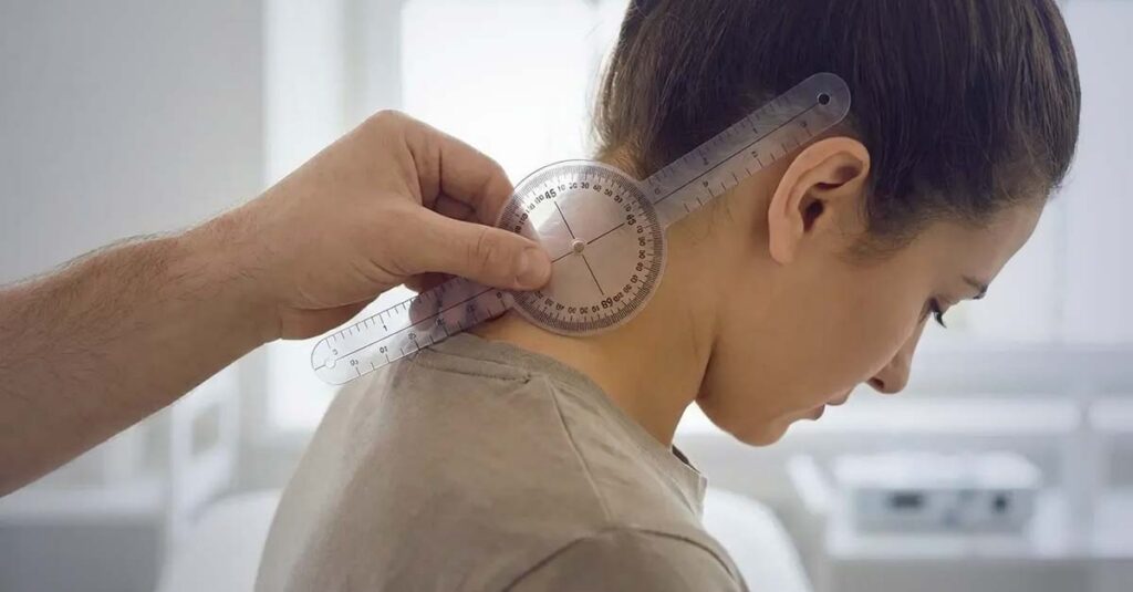 Diagram showing severe neck limitation for high VA rating.