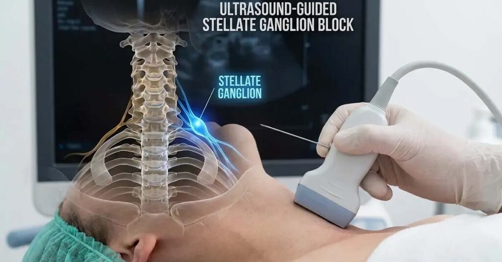 Stellate Ganglion Block for veteran anxiety.