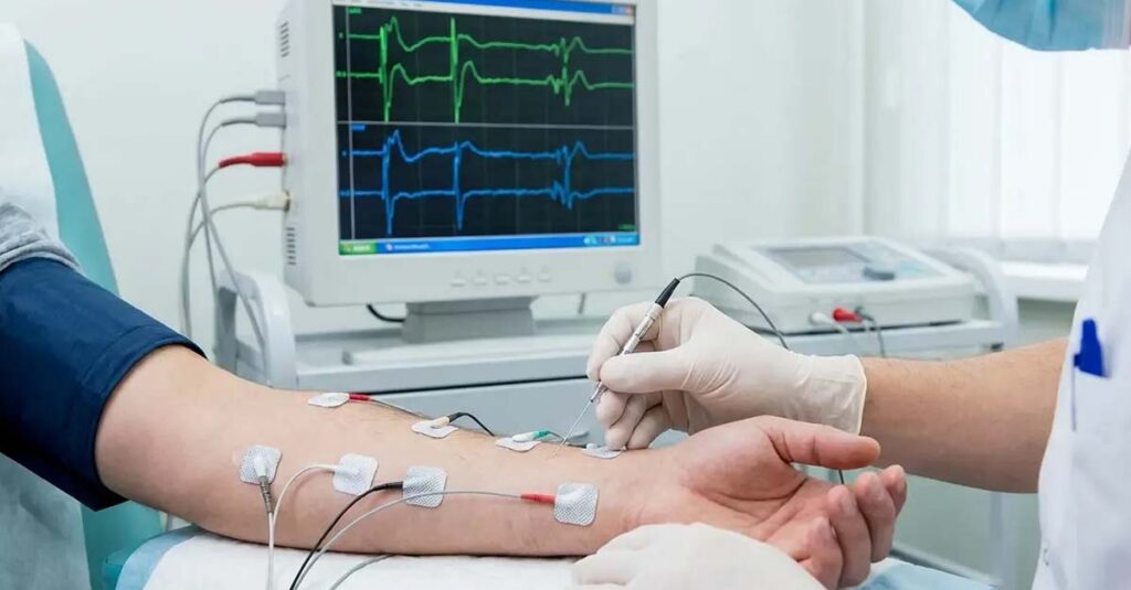 EMG and Nerve Conduction Studies for VA claim evidence.