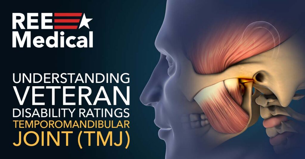 Understanding The VA Rating for TMJ.